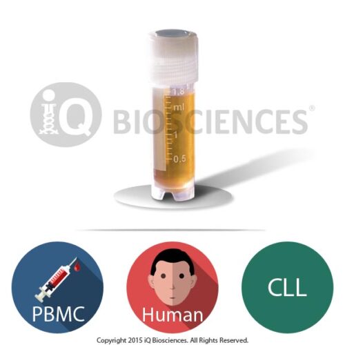 Human CLL PBMCs